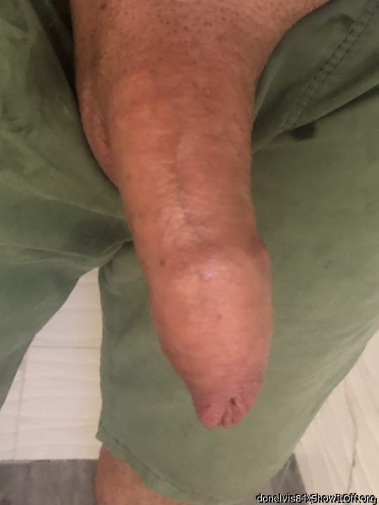 Soft penis