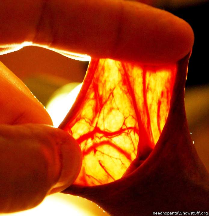 Looks like a beautiful stain-glass window. 