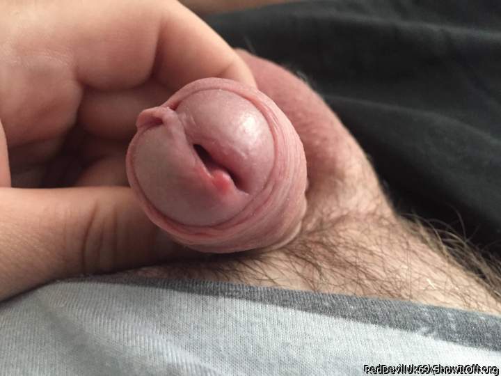 Photo of a penile from RedDevilUk69