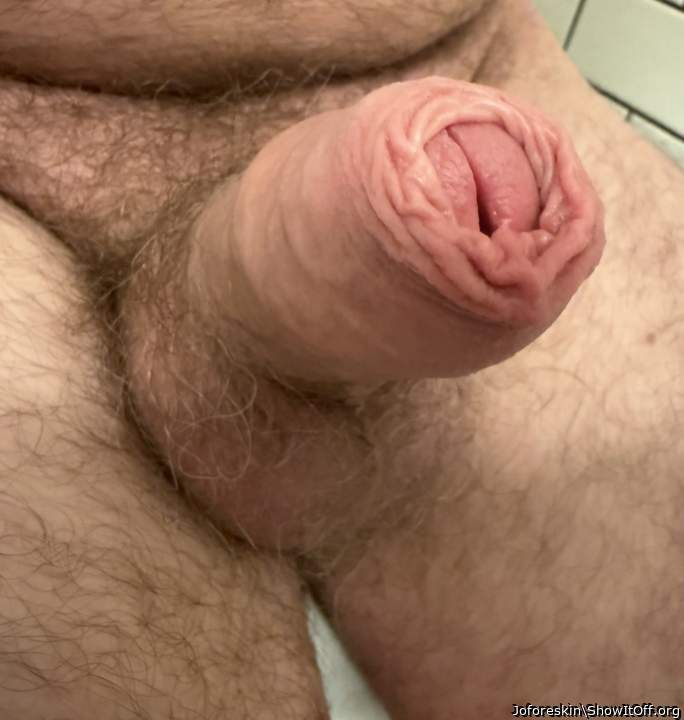 Photo of a third leg from Joforeskin