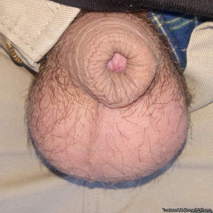 Photo of a middle leg from Tnelson88