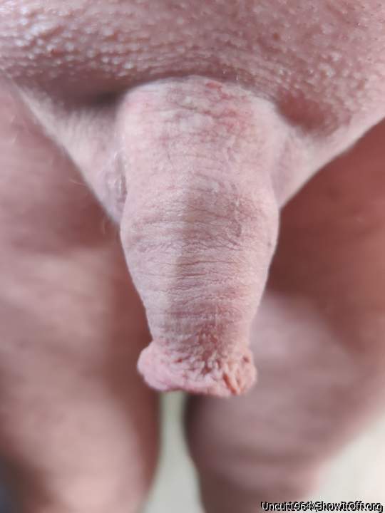 Foreskin