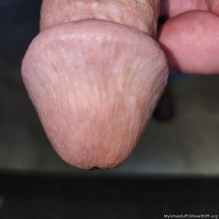 Photo of a penile from Mylimastuff