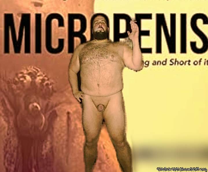 Micropenis
