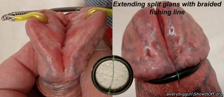Extending Glans Split