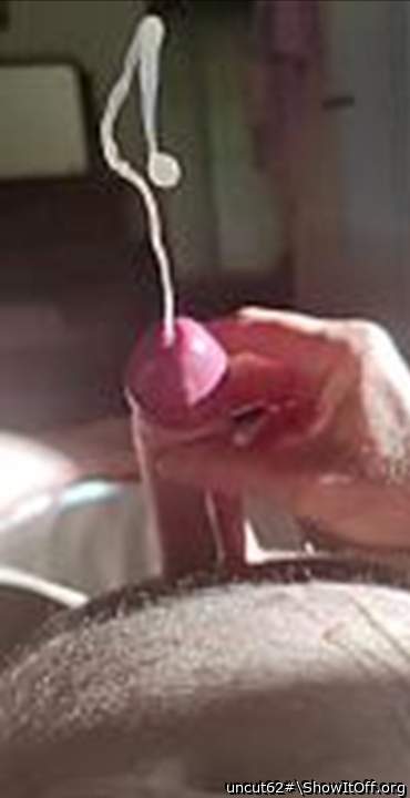 Photo of a penile from uncut62#