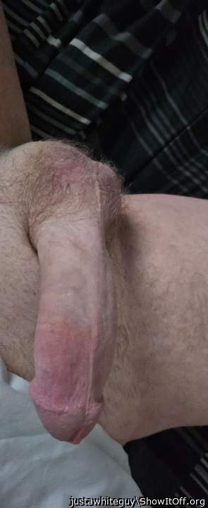 Photo of a meat stick from justawhiteguy