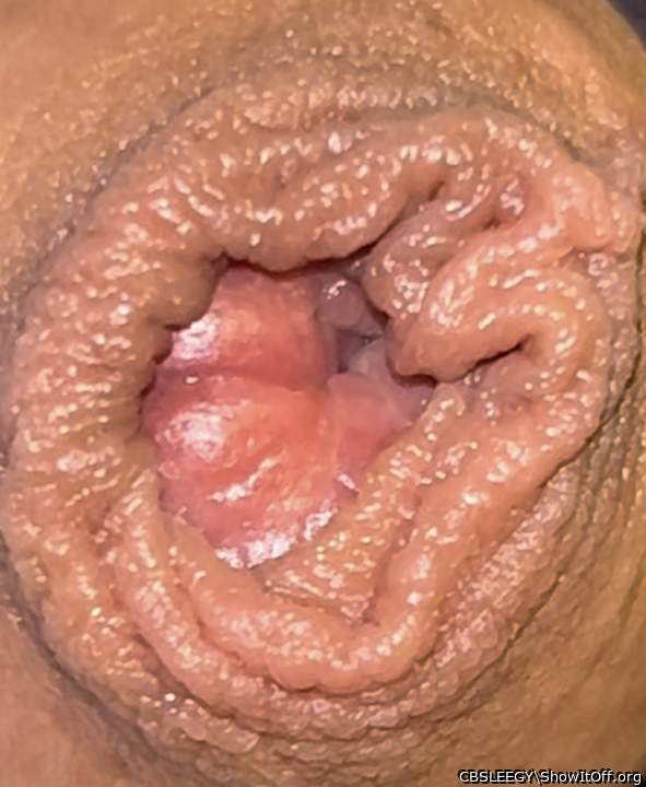 Piss lips not aligning with the chunkiest part of my foreskin!