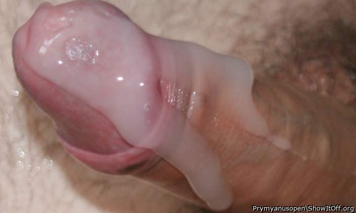 Photo of a penile from Prymyanusopen
