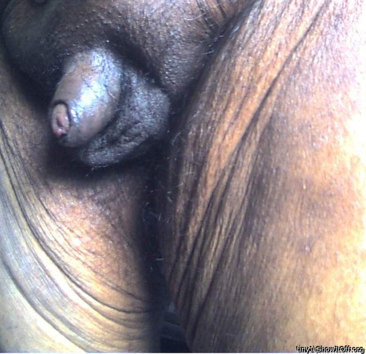 Photo of a penile from tiny1