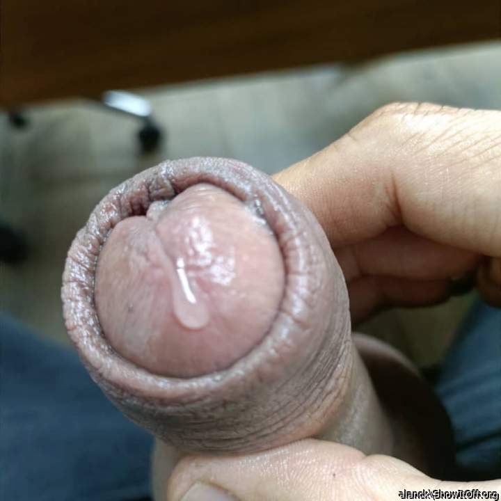 Photo of a middle leg from alanck