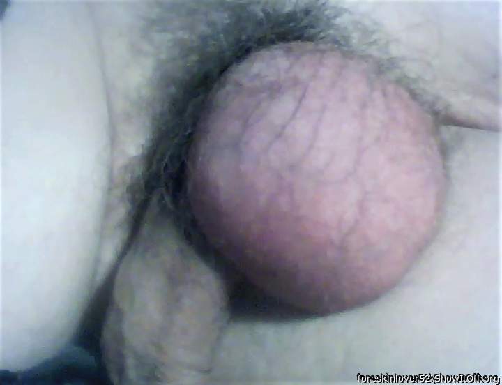 Photo of a one-eyed monster from foreskinlover52