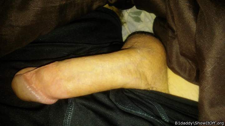 Photo of a middle leg from B1daddy