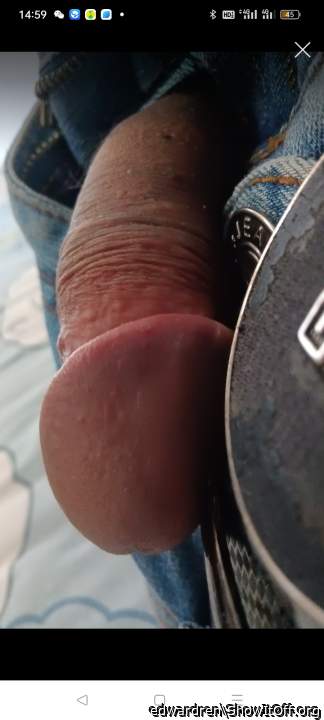 Photo of a phallus from edwardren