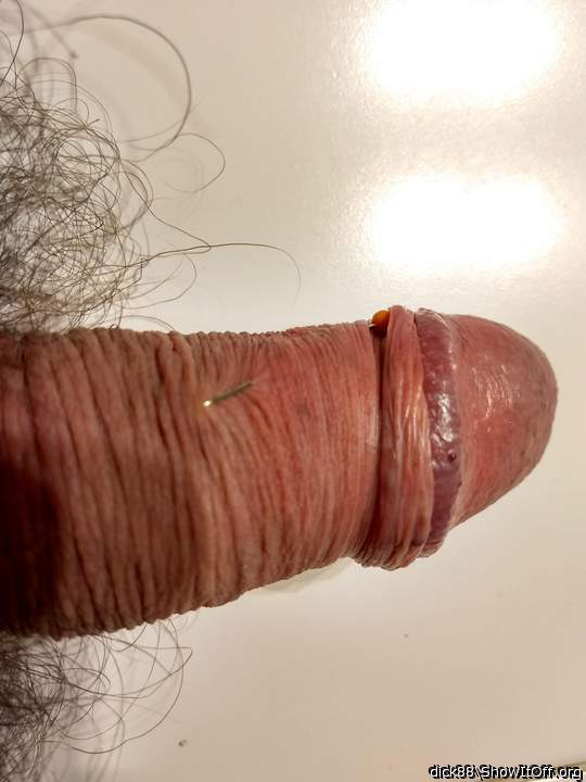 Photo of a penile from Dick88
