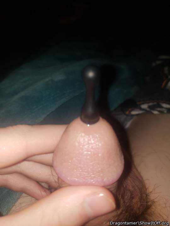 Photo of a penile from Dragontamer
