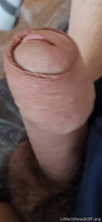 Photo of a short leg from Little