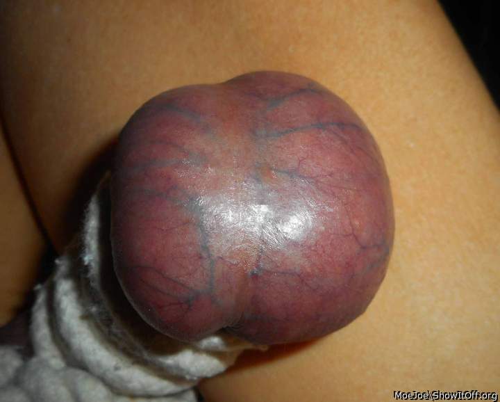 Purple veiny balls