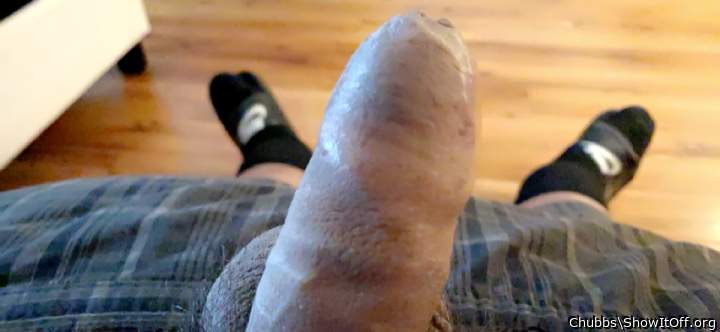 Foreskin Friday