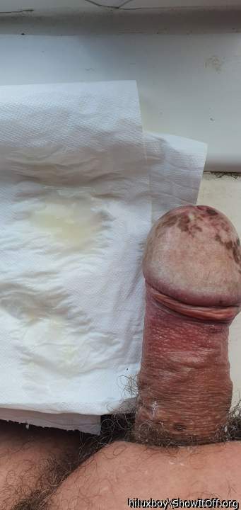 Photo of a schlong from hiluxboy