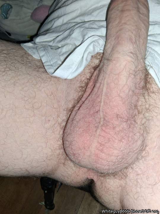 Photo of a penile from Whiteguy8655