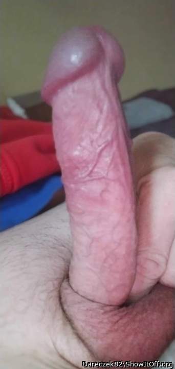 Photo of a short leg from Dareczek82