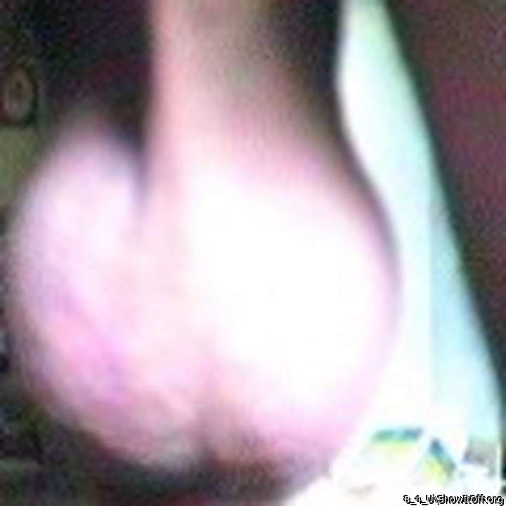 Testicles Photo from 8_4_U
