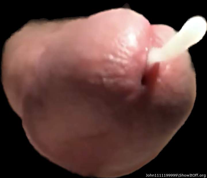 Photo of a penile from John1111199999