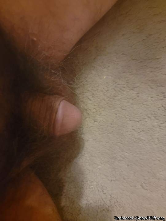 Photo of a penile from Smbicock