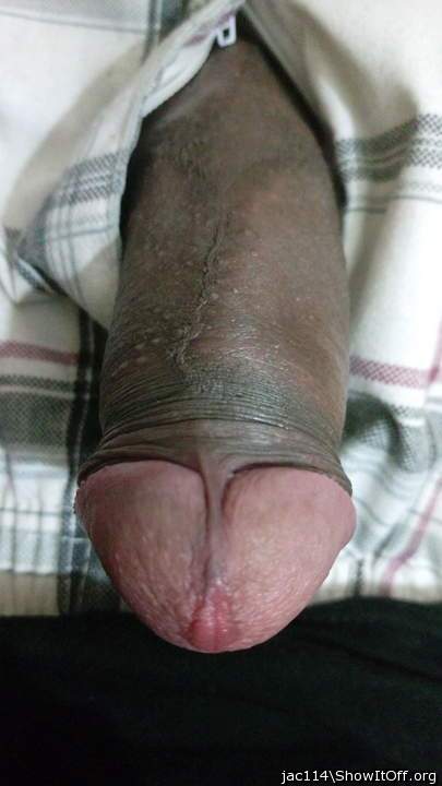 Photo of a short leg from jac114