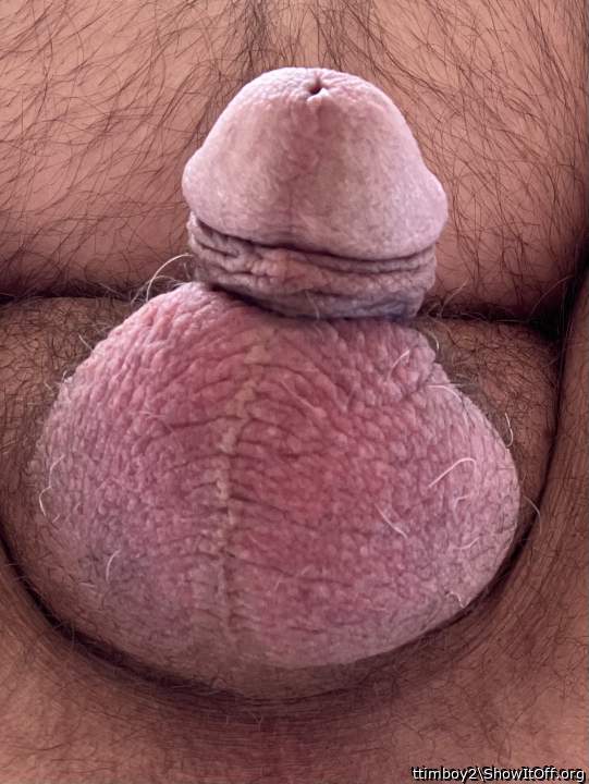 Photo of a penis from ttimboy2