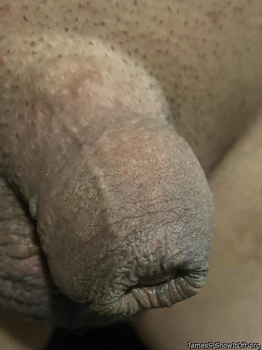 When I released the pegs it looked like I had a foreskin.