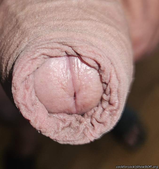 My awesome foreskin