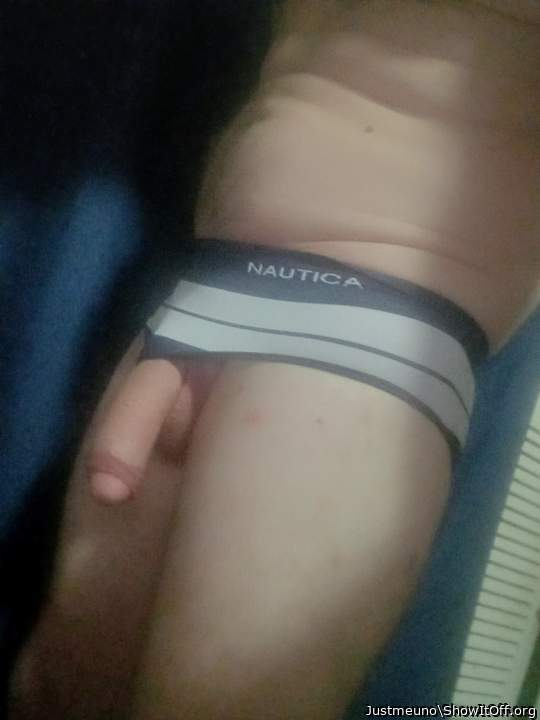 Photo of a bald-headed mouse from Justmeuno