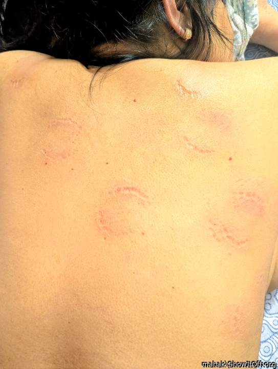 Photo of a penile from mahak