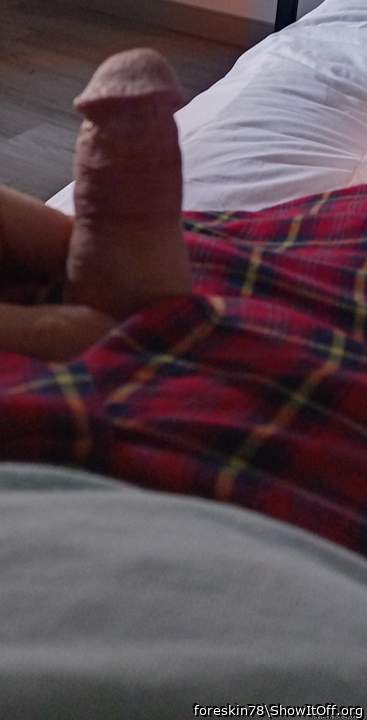 Photo of a third leg from foreskin78
