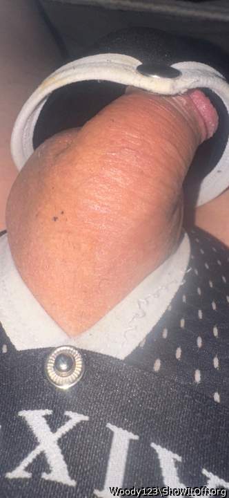 Photo of a private part from Woody123