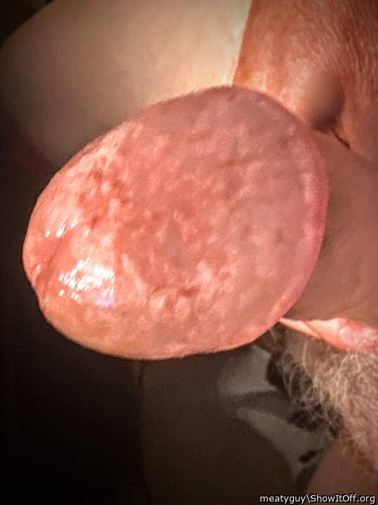 Photo of a penile from meatyguy