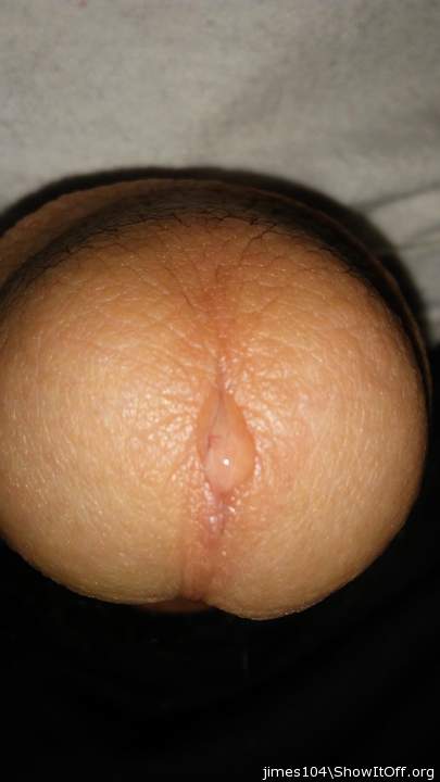 Photo of a penile from jimes104