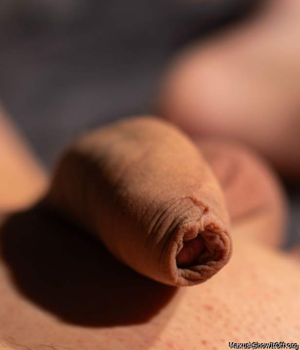 macro Foreskin2