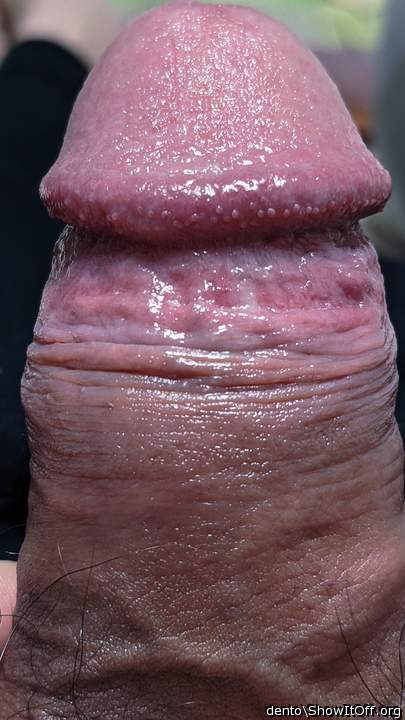 Photo of a penile from dento