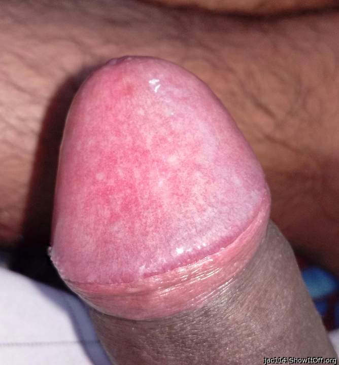 Photo of a penile from jac114