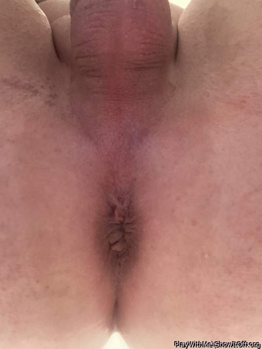 My asshole