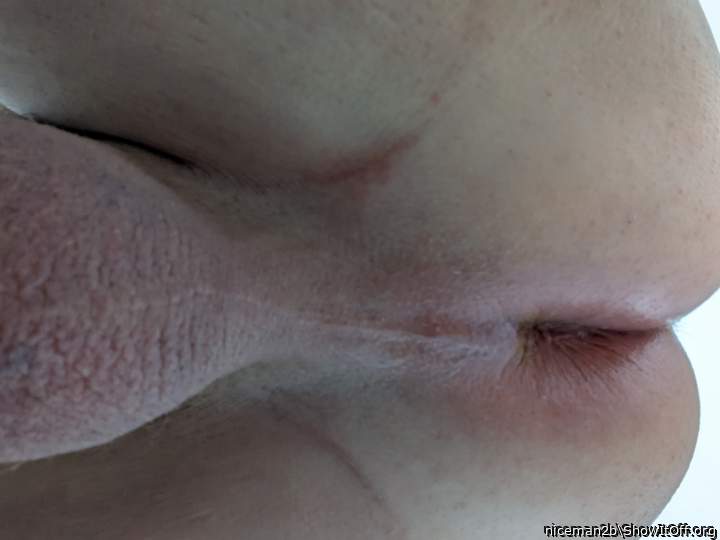 Anus hole