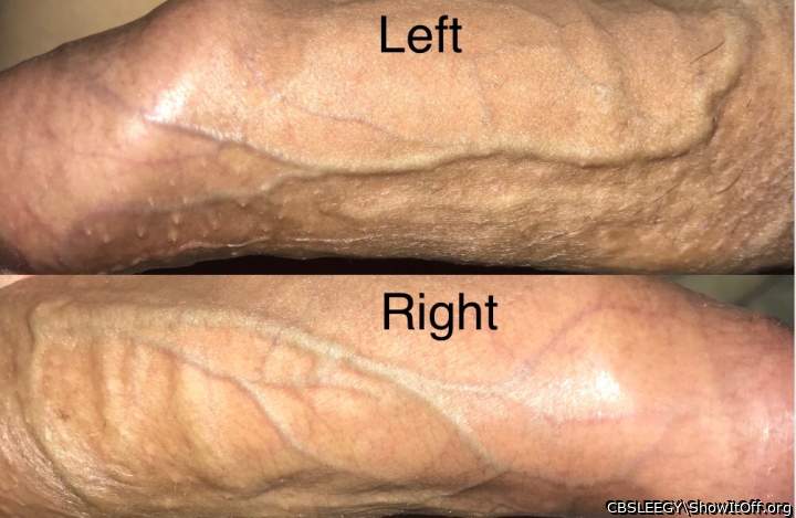 Vein structures left & right