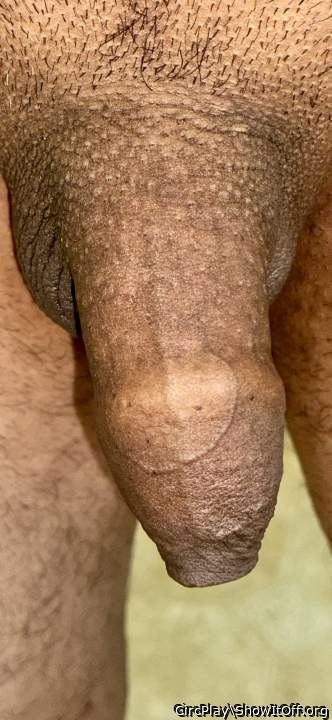 Photo of a private part from CircPlay