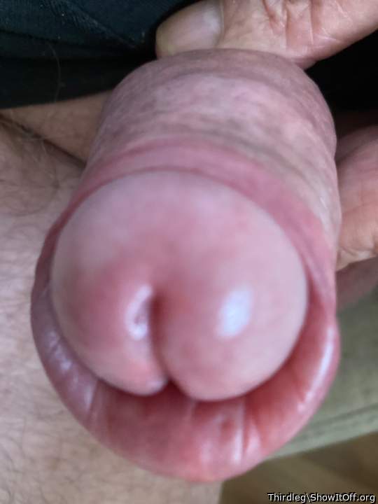 beautiful foreskin 