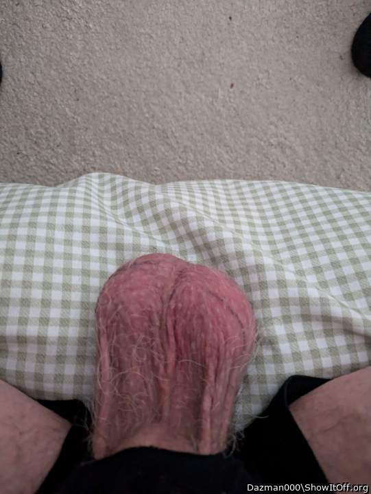 Photo of a prick from Dazman000