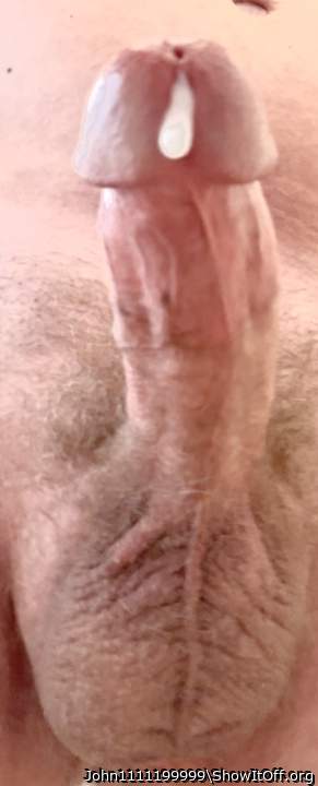 Photo of a prick from John1111199999