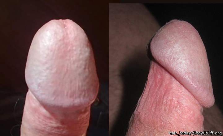 So sexy. Perfect glans!  